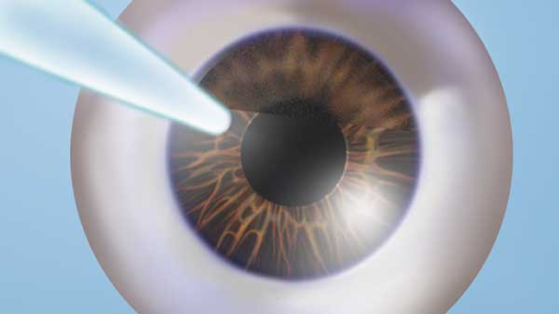 Your eyes can feel fine while something is changing